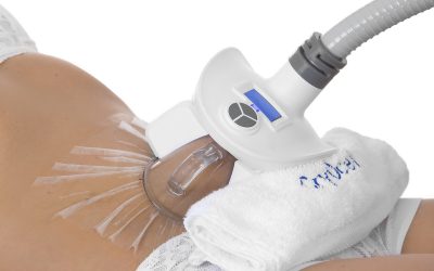 Comment réduire votre cellulite ?